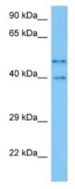PRB1 Rabbit anti-Human, Polyclonal, Novus Biologicals:Antibodies:Primary